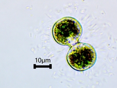 Cosmarium contractum