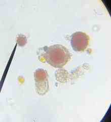 Chlamydomonas nivalis