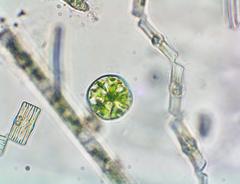 Asterococcus limneticus