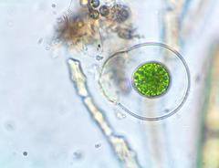 Asterococcus