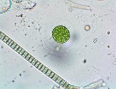Asterococcus