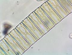 Fragilaria