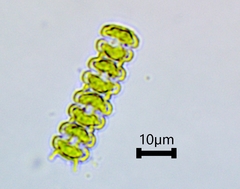Sphaerozosma filiforme