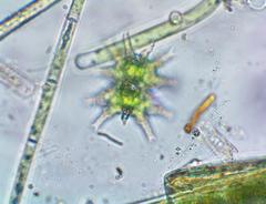 Staurastrum furcigerum