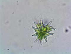 Staurastrum furcigerum