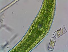 Closterium leibleinii