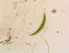 Closterium leibleinii