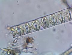 Fragilaria