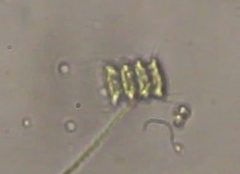 Scenedesmaceae