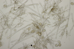 Peronospora alta