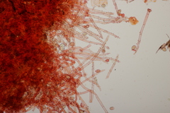 Botryobasidium conspersum