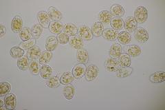 Pucciniastrum epilobii