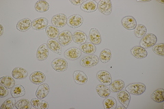 Pucciniastrum epilobii