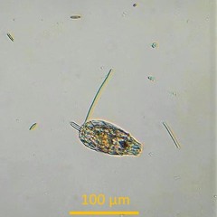 Lecane undulata