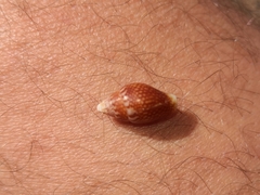 Pardalinops testudinaria