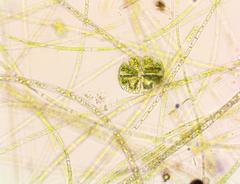 Micrasterias truncata