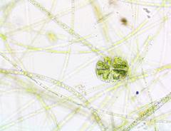 Micrasterias truncata