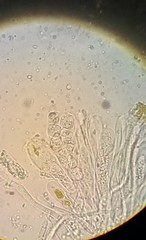 Variospora aurantia