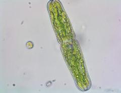 Tetmemorus brebissonii