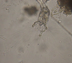 Collotheca
