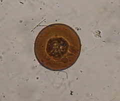 Arcella vulgaris