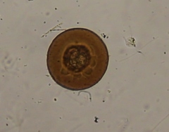 Arcella vulgaris