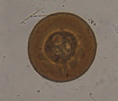 Arcella vulgaris