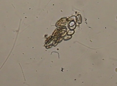 Cocconeis pediculus