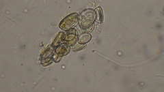 Cocconeis pediculus