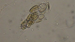 Cocconeis pediculus