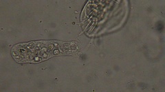 Amoeba