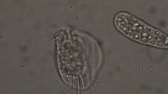 Amoeba