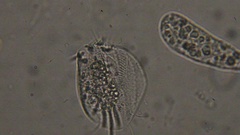 Amoeba