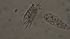 Amoeba