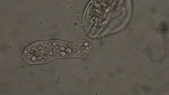 Amoeba
