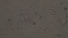 Amoeba