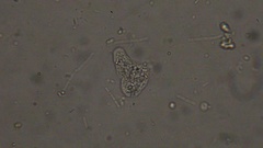 Amoeba