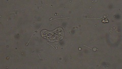 Amoeba