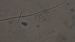 Amoeba