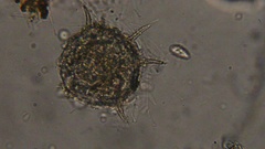 Arcellinida