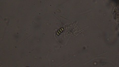 Scenedesmaceae