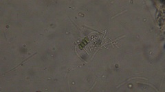 Scenedesmaceae