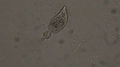 Lacrymaria olor
