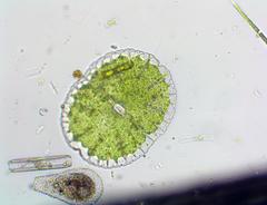 Micrasterias denticulata