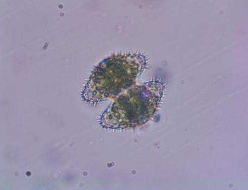 Staurastrum pilosum