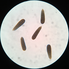 Berkleasmium concinnum