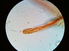 Pezicula carpinea