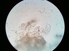 Pezicula carpinea