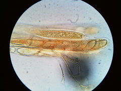 Pezicula carpinea