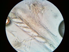 Pezicula carpinea